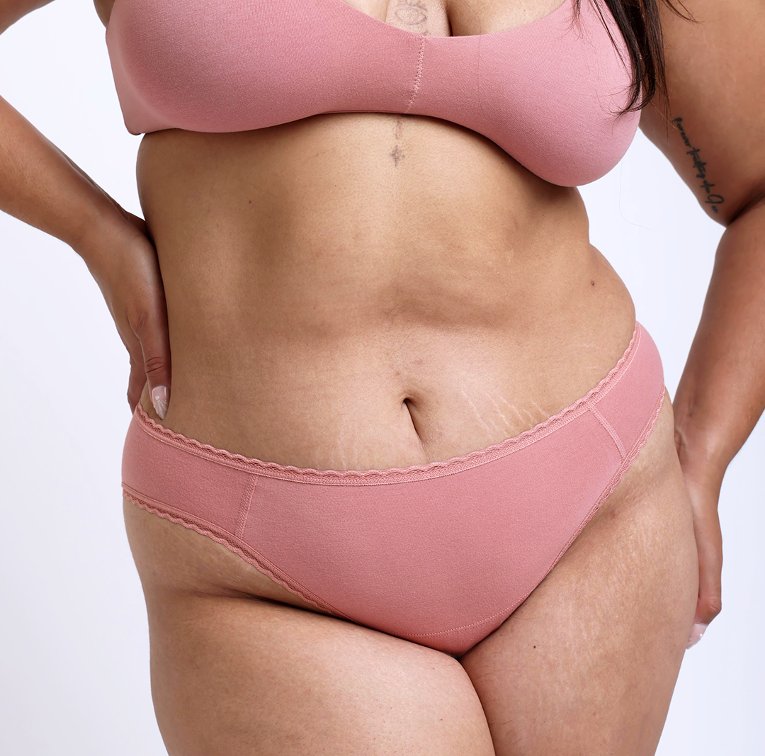 Mid Rise Brief