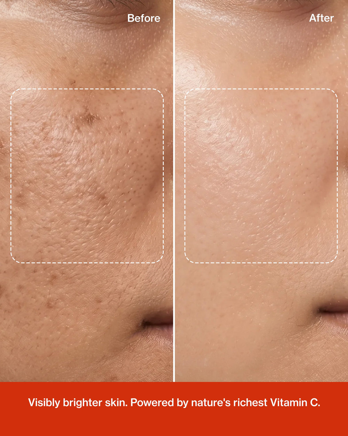 Glow Vitamin C Serum: Astaxanthin X Amla Oil (Tridoshic)