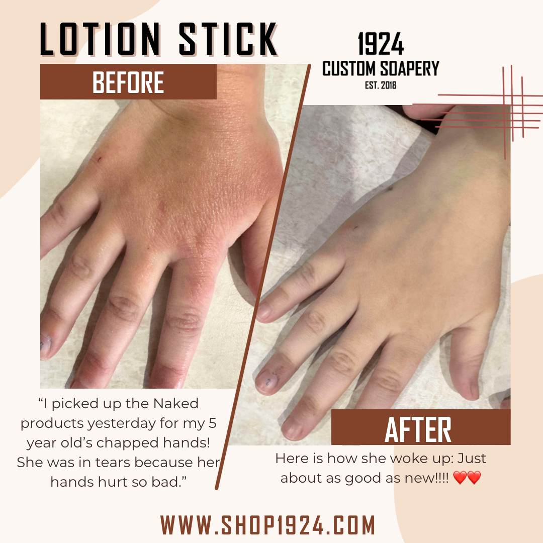 Lotion Sticks