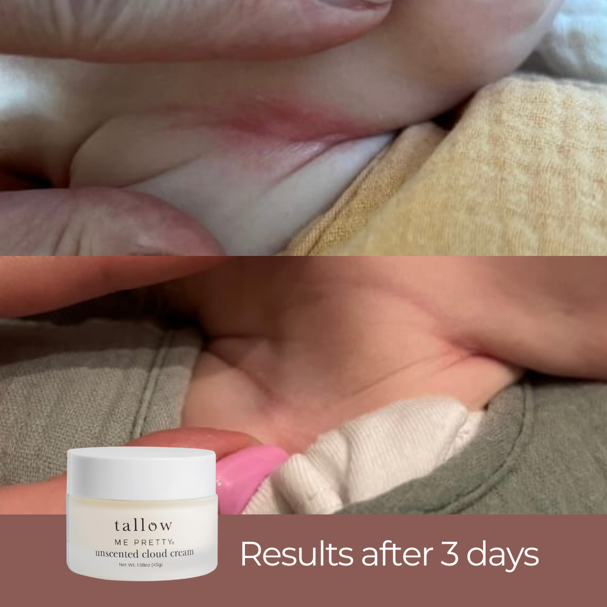 Unscented Cloud Cream