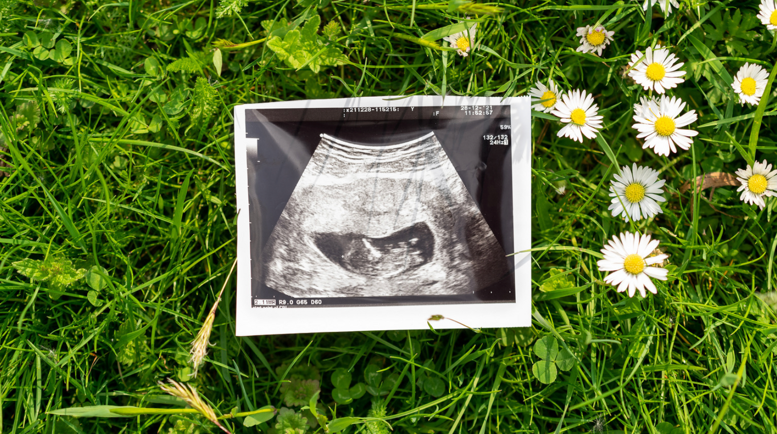 Pregnancy, Clean Beauty and Bare Feet on the Grass — Life at 7 Months