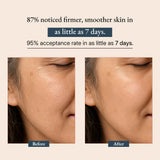 Supercharge Vitamin A Serum - with Bakuchiol Oil (Tridoshic)