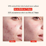 Glow Vitamin C Serum: Astaxanthin X Amla Oil (Tridoshic)