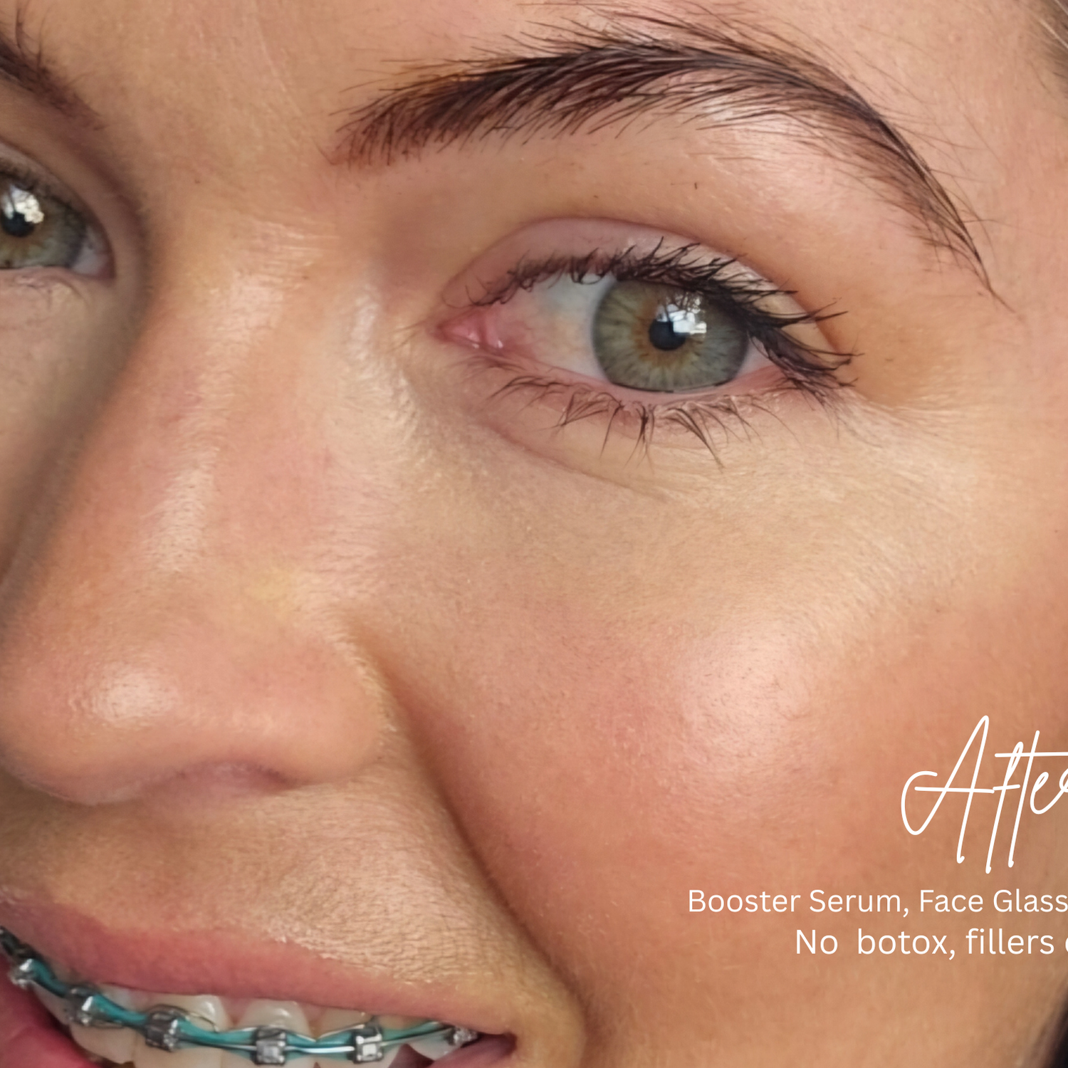 Ageless Luxury: Organic Age-Defy Booster Serum