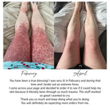 Fragrance Free Tallow + Honey Cream for Sensitive Skin