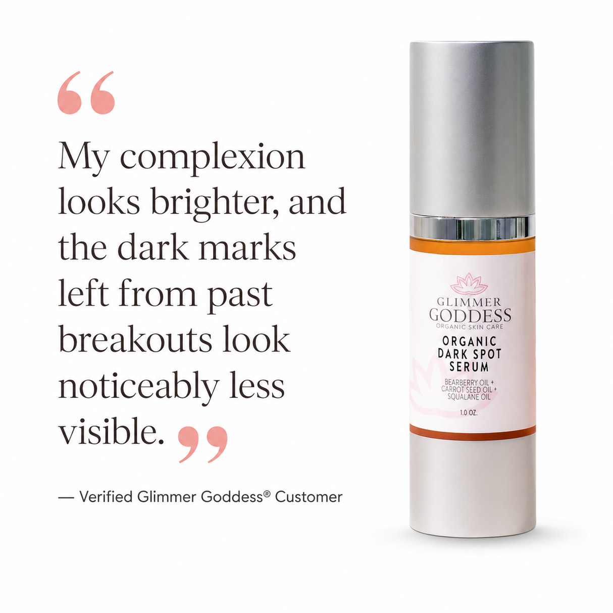 Organic Dark Spot Serum – Brightens & Evens Skin Tone