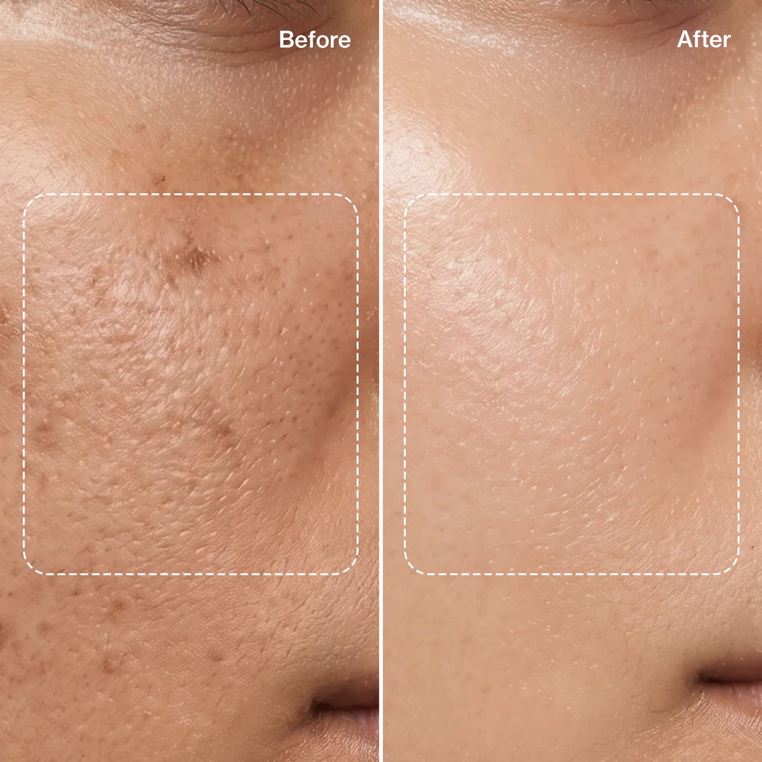 Glow Vitamin C Serum: Astaxanthin X Amla Oil (Tridoshic)
