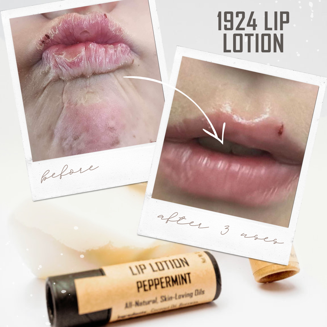 Lip Lotions