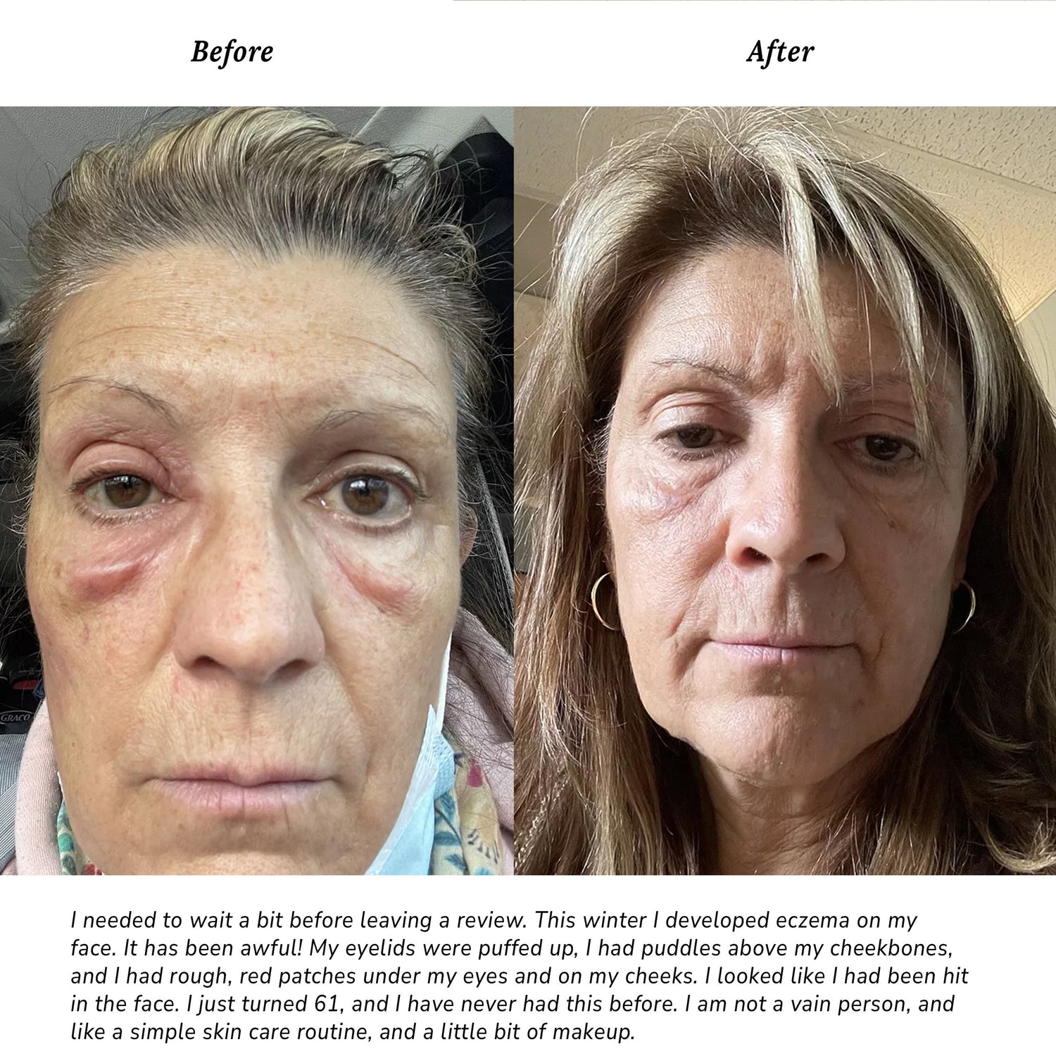 Pure + Simple Skin Kit for Sensitive Skin