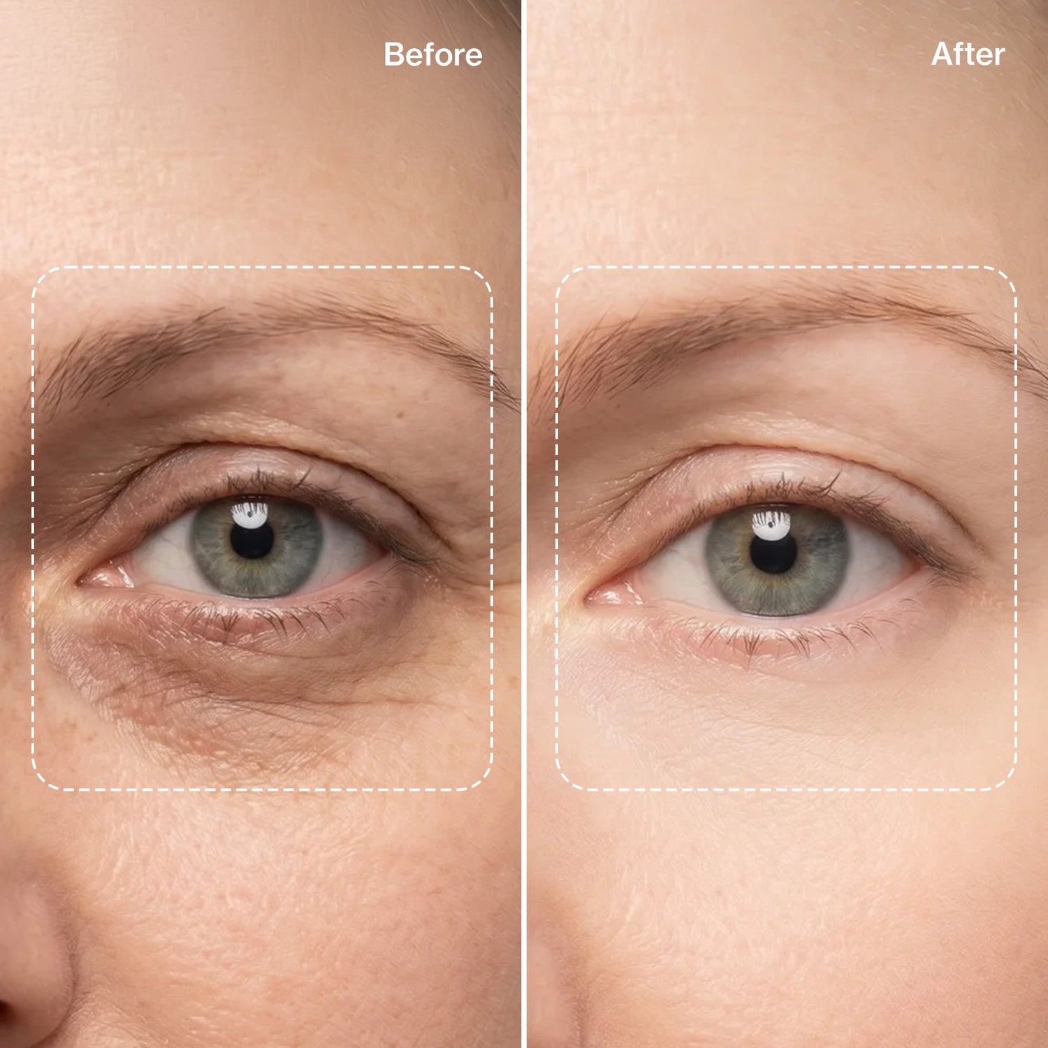 Supercharge Vitamin A Serum - with Bakuchiol Oil (Tridoshic)