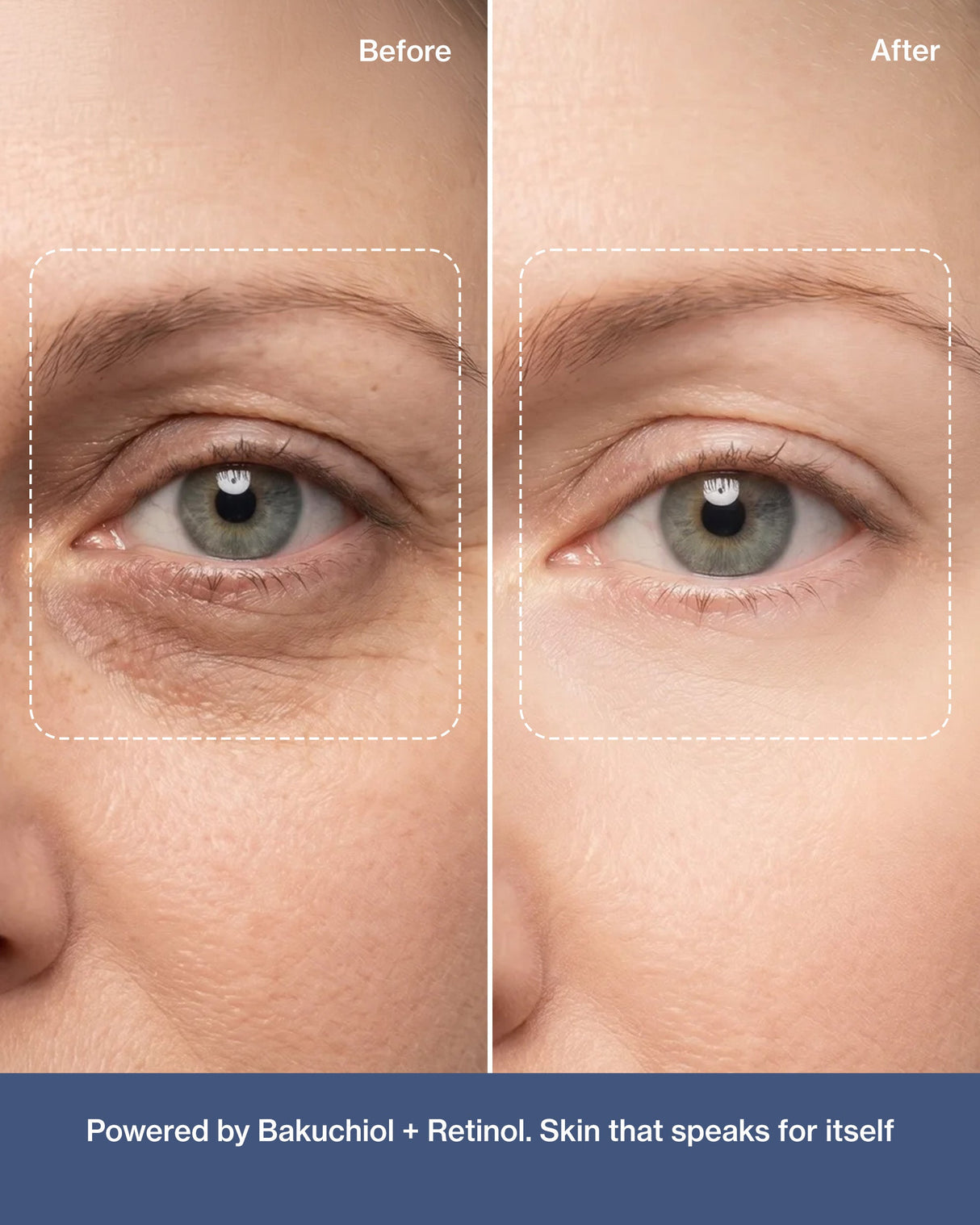 Supercharge Vitamin A Serum - with Bakuchiol Oil (Tridoshic)