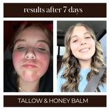 Tallow & Honey Balm