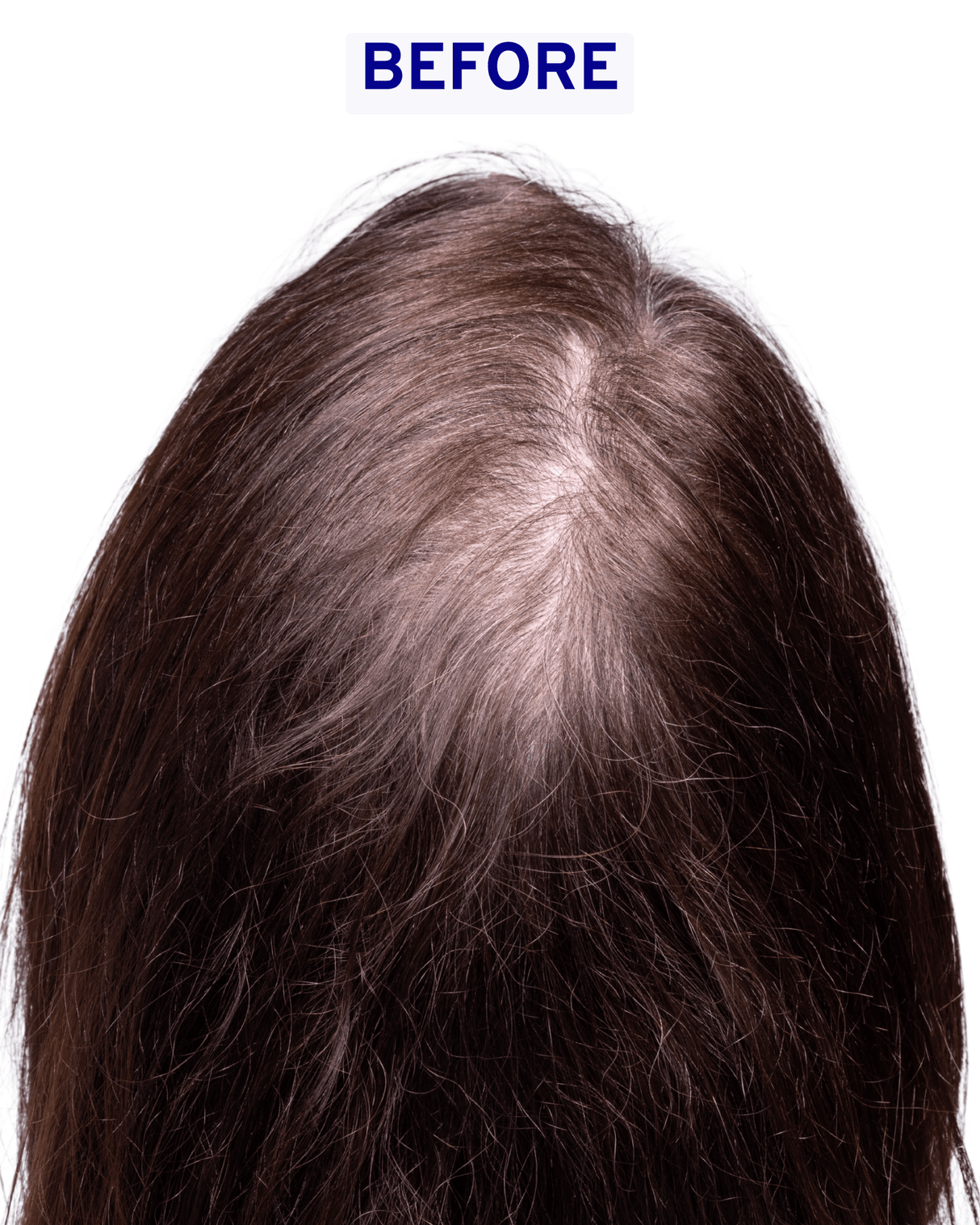 Hair & Scalp Serum | Hydration & Shine