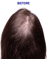 Hair & Scalp Serum | Hydration & Shine