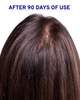 Hair & Scalp Serum | Hydration & Shine