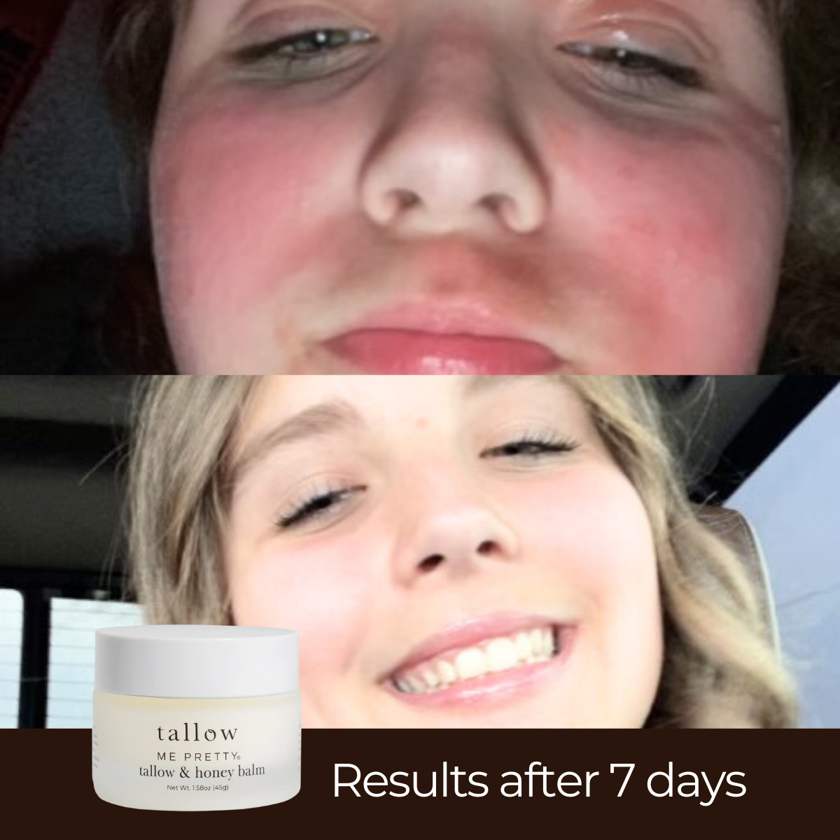 Tallow & Honey Balm